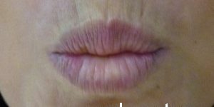 kisetnie-morschini-1-300×232