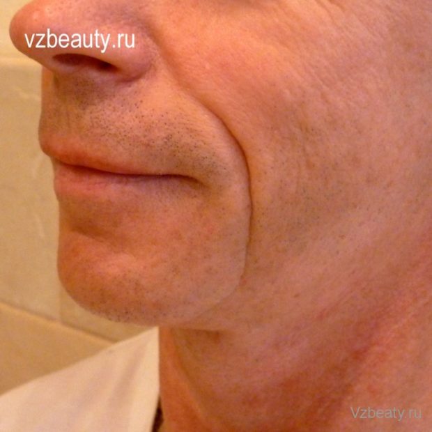 zns-do-pr-vzbeauty big