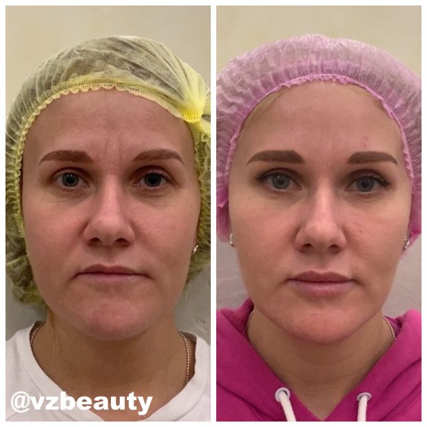 vzbeauty