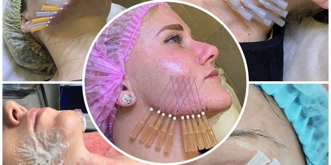 92148997_220116882640678_7122395228241367779_n