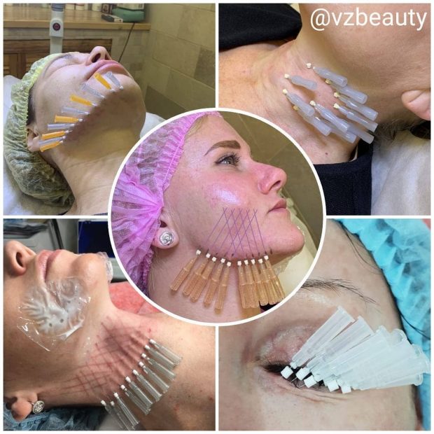 92148997_220116882640678_7122395228241367779_n