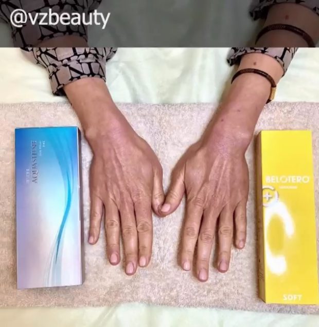 уход за руками