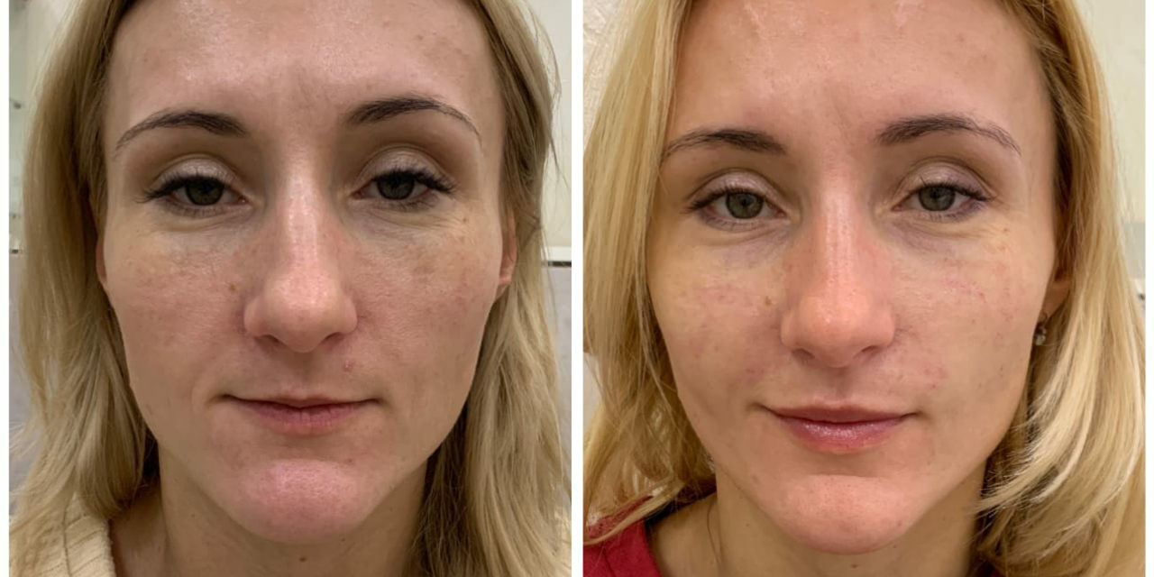 collagemaker_20201012_093606433