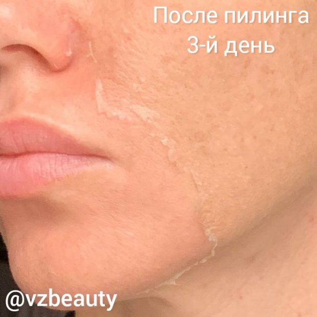 vzbeauty_123143926_351648865941072_1865130439862487070_n
