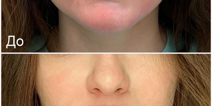 collagemaker-dlya-sajta