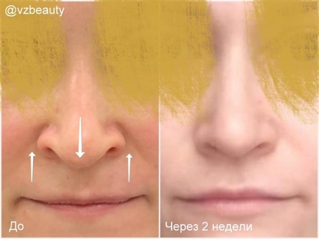 mi_22012021_135019fin-sajt