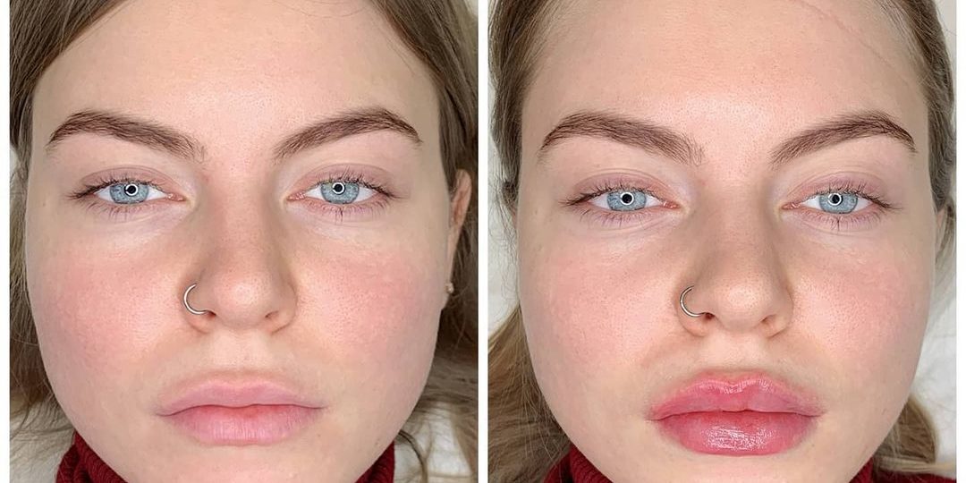 vzbeauty_137023387_409461070270288_2450896644952774794_n