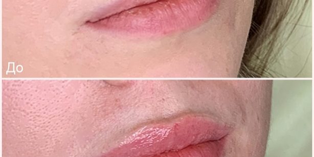 collagemaker_20210215_133059986-sajt