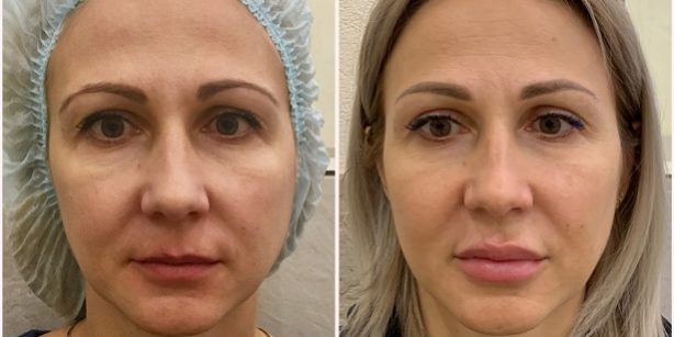 collagemaker_20210421-sajt