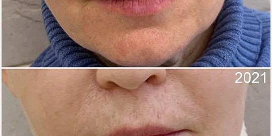 vzbeauty_172977262_181416903799773_8779141587698104475_n