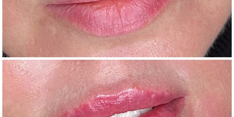 gridart_20220331_183325398