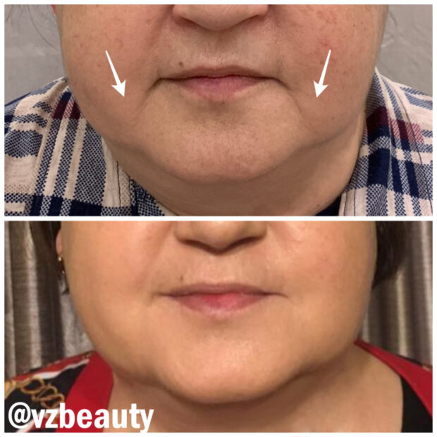 gridart_strelki-sajt