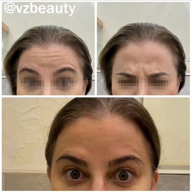 vzbeauty_283823344_1087560392189313_6465645783177025697_n.mp4_snapshot_00.03.008