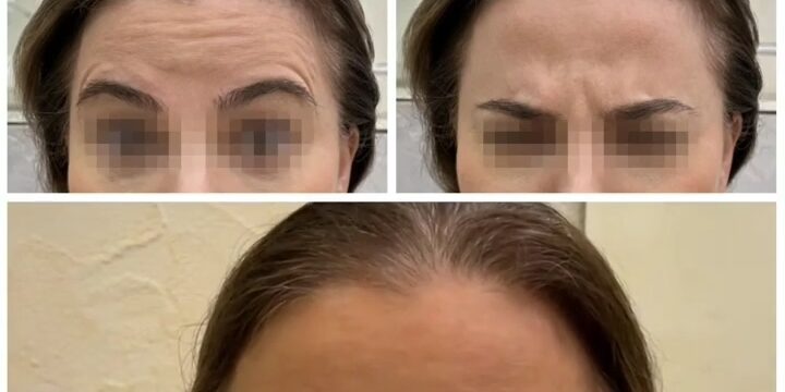 vzbeauty_283823344_1087560392189313_6465645783177025697_n.mp4_snapshot_00.03.008