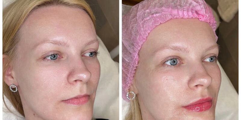 img_20220720_084026_252