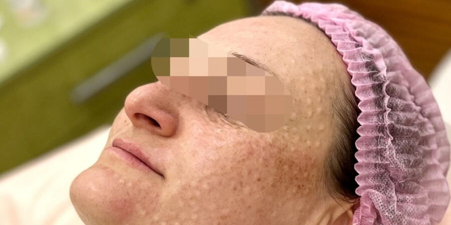 vzbeauty_307417775_1160274724898736_8702978976379830847_n