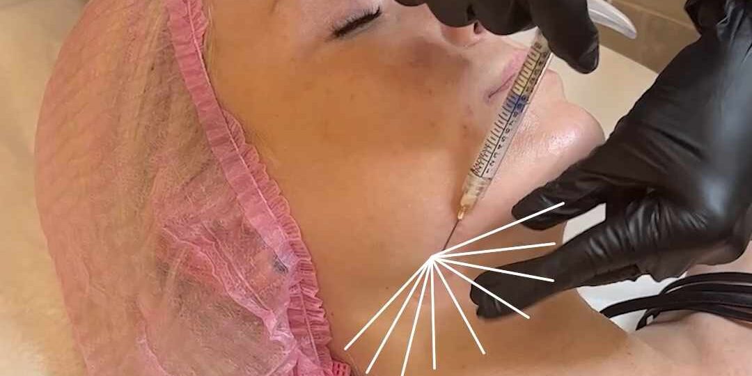 Шея видео.mp4_snapshot_00.13.964