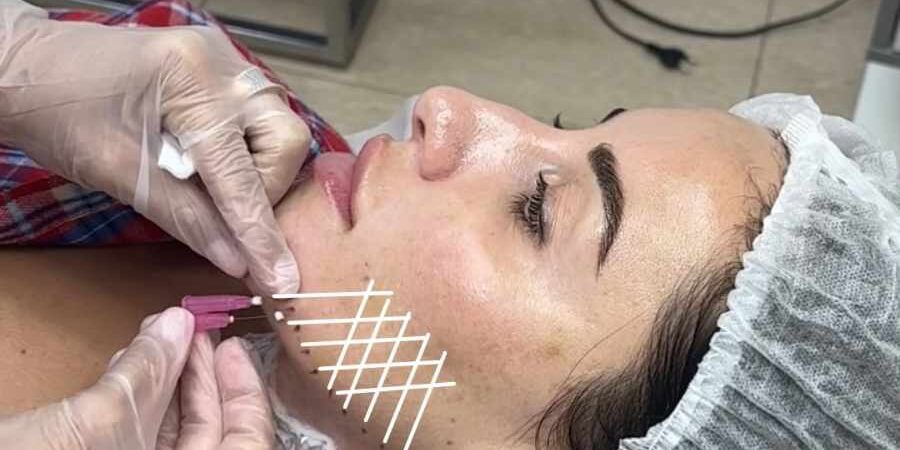 0908 (1).mp4_snapshot_00.02.403