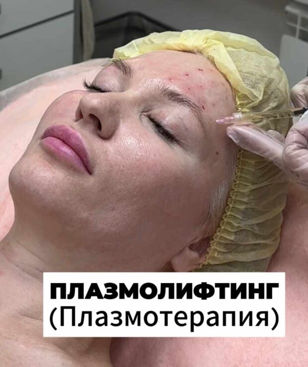 плазма 1