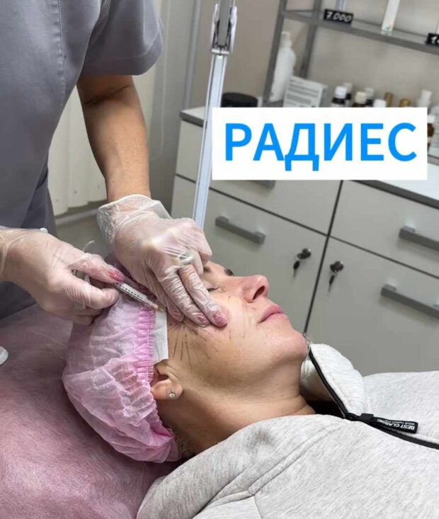 Радиес