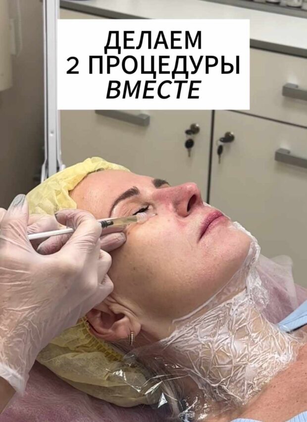 плаза и нити