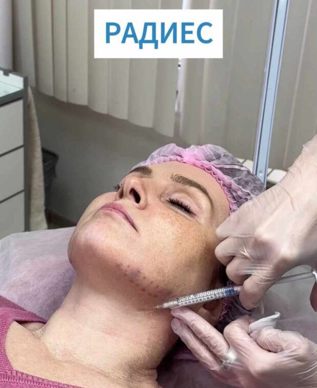 радиес шея